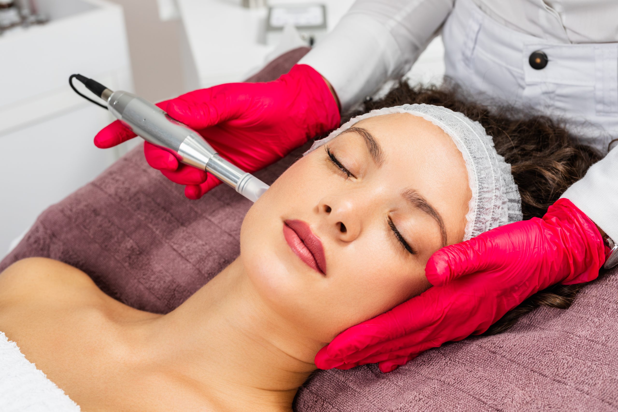 Femme recevant un soin de rajeunissement par microneedling