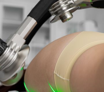 Traitement laser du corps pour le remodelage de la silhouette