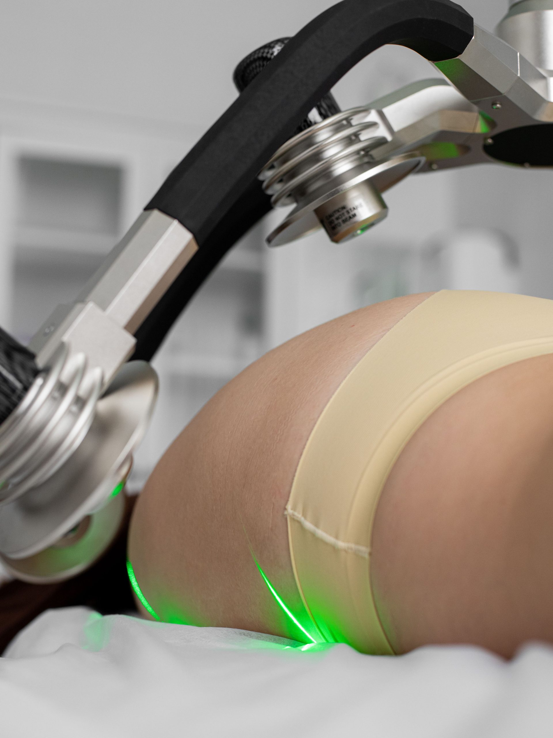 Traitement laser du corps pour le remodelage de la silhouette