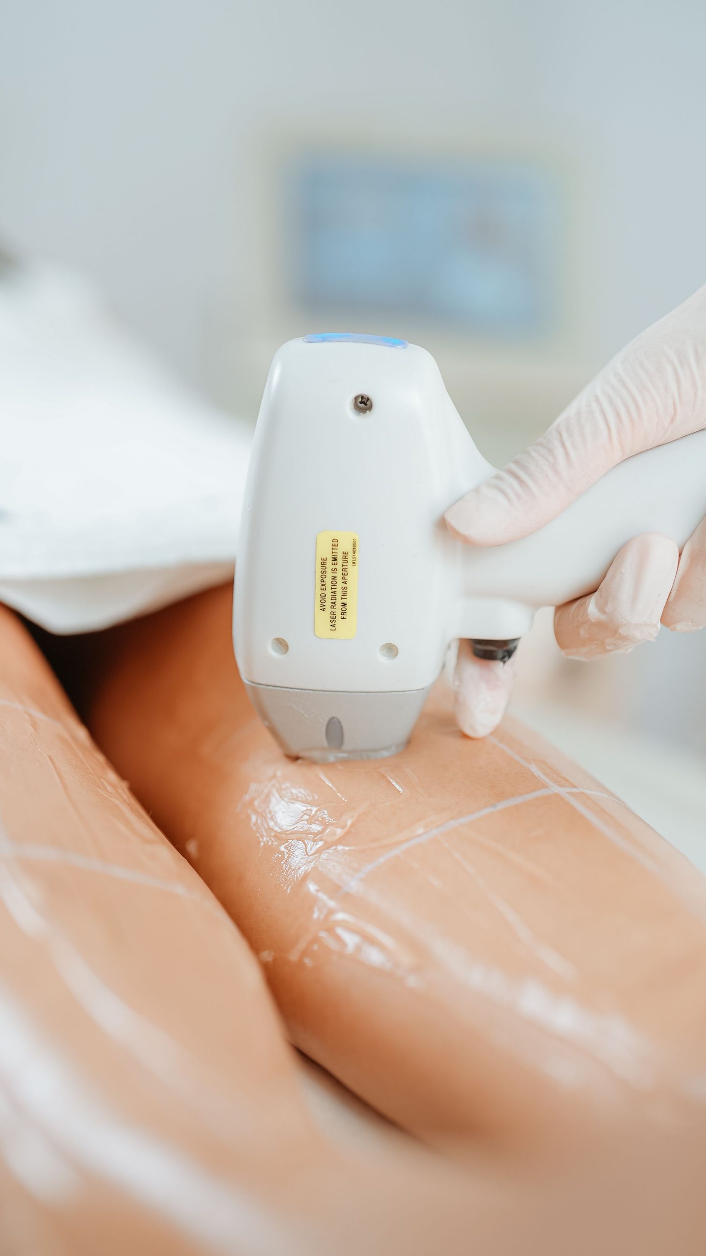 Épilation laser diode sur les jambes en institut